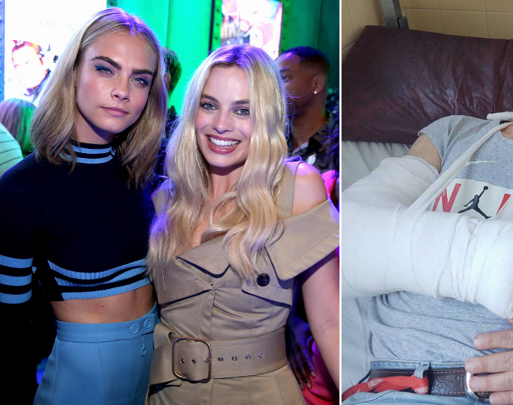 Atacaron brutalmente a un hombre que quiso fotografiar a Margot Robbie en Argentina