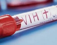 Avance contra el VIH: un tercer paciente logró controlar al virus tras un trasplante de médula