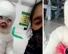 Una nena de 3 años fue víctima de un lamentable accidente en un restaurante 