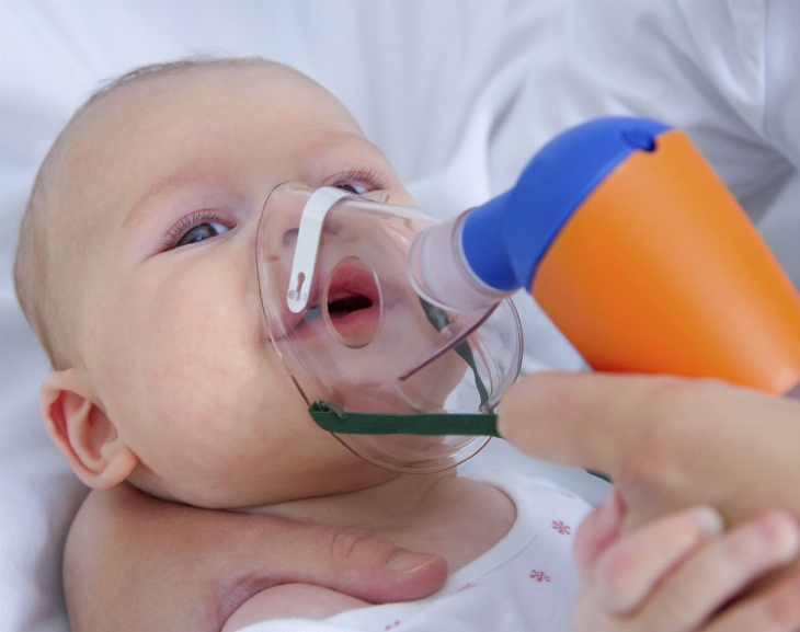 Bronquiolitis: aseguran que la ola recién inicia