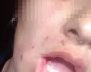Se enojó con su novia y la tiró de la moto andando 