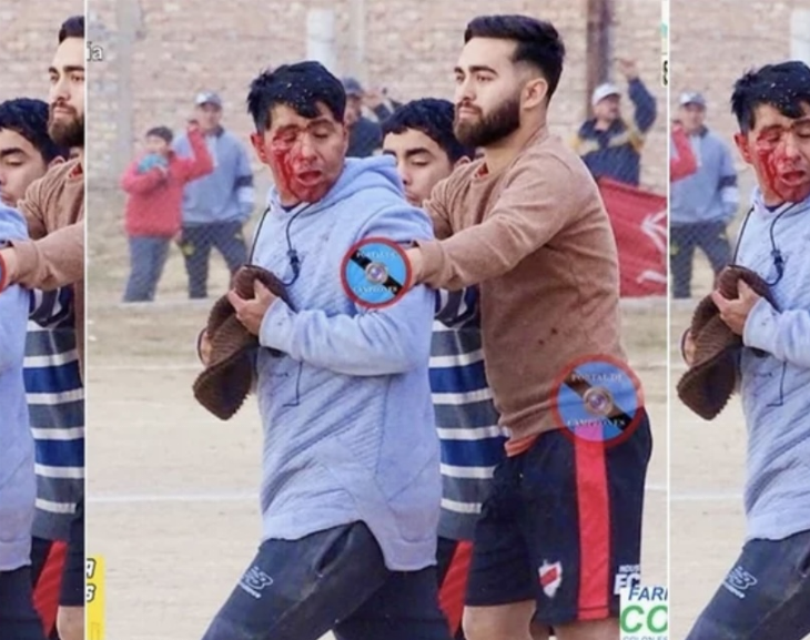 Un arquero agredió a un ayudante de cancha y lo dejó herido 
