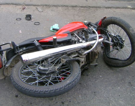 ¡Se bajó los dientes de un porrazo! Terrible accidente en Capital