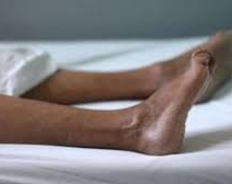 Un hombre murió electrocutado mientras usaba un juguete sexual