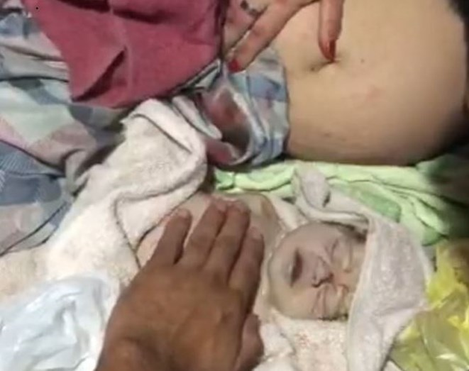 Un bebé que nació sin signos vitales fue reanimado por un polícia y se salvó