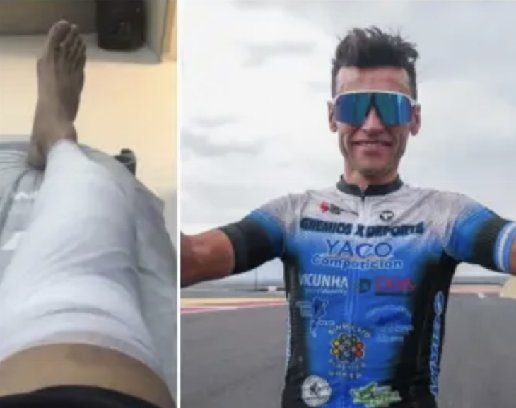 Un ciclista sanjuanino sufrió un terrible accidente en su moto