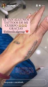 El costoso tratamiento que sigue Mica Tinelli para quitarse sus tatuajes 