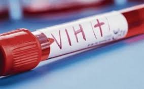 Avance contra el VIH: un tercer paciente logró controlar al virus tras un trasplante de médula
