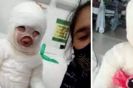 Una nena de 3 años fue vÃctima de un lamentable accidente en un restaurante