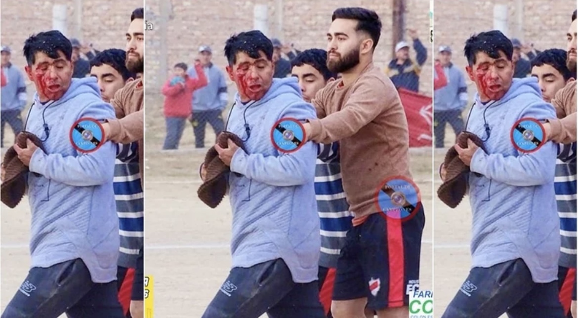 Un arquero agredió a un ayudante de cancha y lo dejó herido 
