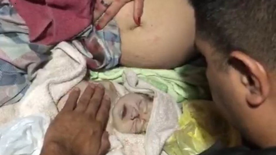 Un bebé que nació sin signos vitales fue reanimado por un polícia y se salvó