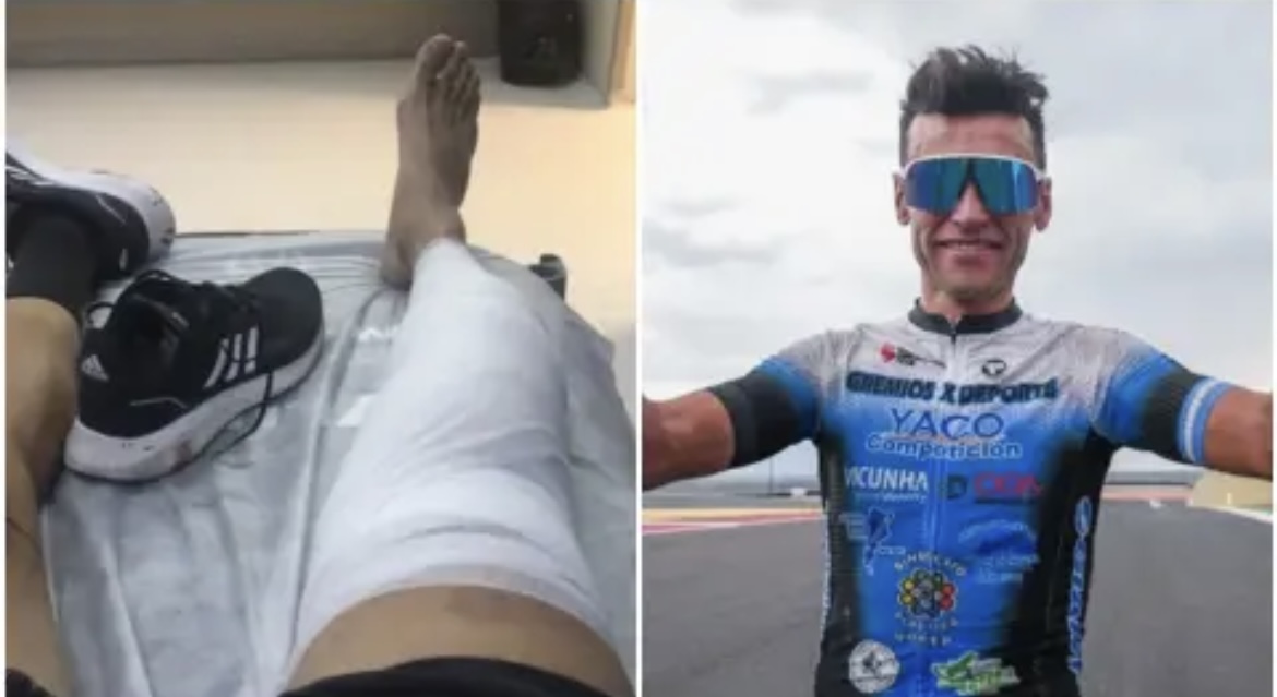 Un ciclista sanjuanino sufrió un terrible accidente en su moto
