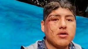 Tras una fiesta, se despertó en un ataud: se aprovecharon de que estaba borracho