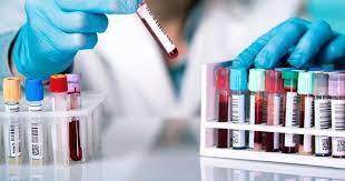 Los Bioquímicos se suman a la ola y comienzan a cobrar un costoso plus 