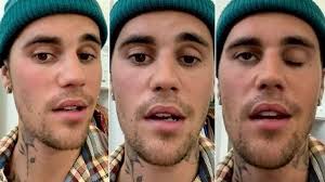 Justin Bieber canceló varios shows de su gira por sufrir una parálisis facial