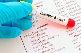 Un estudio vincula la hepatitis grave detectada en niños con el coronavirus