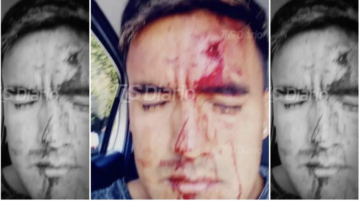 Asaltaron y golpearon salvajemente a un jugador de Alianza